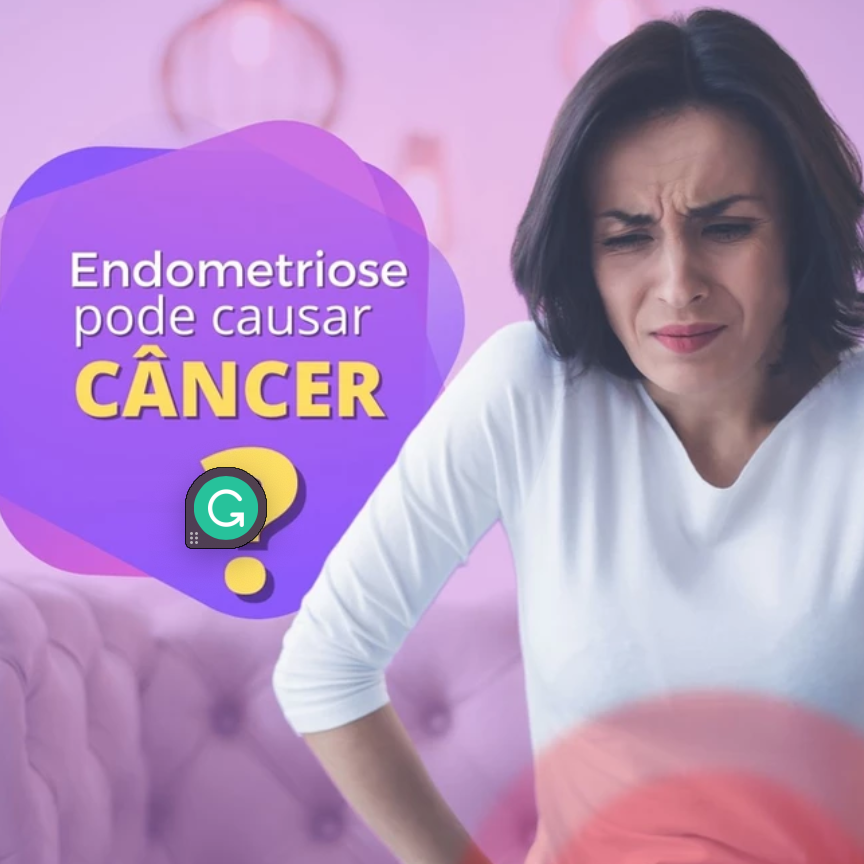 endometriose intestinal pode causar cancer